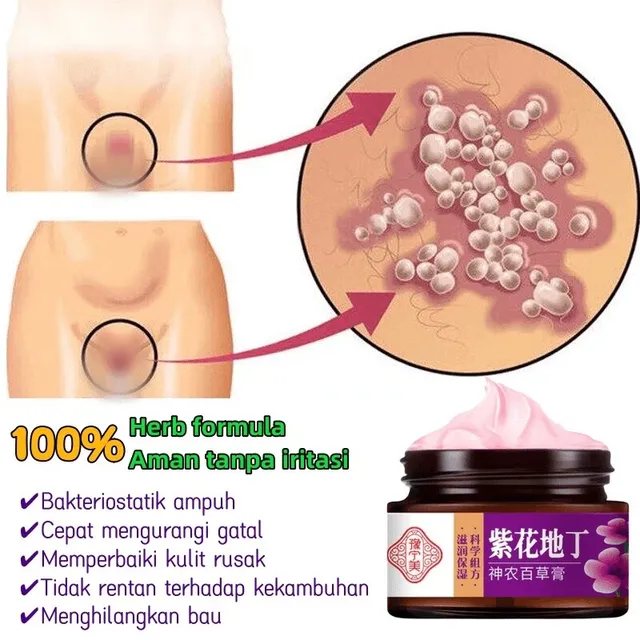 Kem B&ocirc;i ngừng hẳn Sạch Nấm - Giải Ph&aacute;p Chăm S&oacute;c V&ugrave;ng K&iacute;n