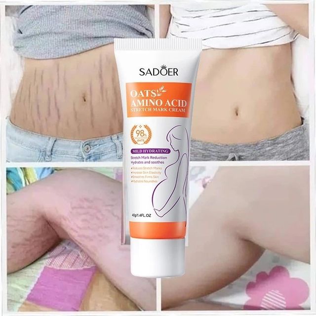 Kem l&agrave;m mờ rạn da Anti-stretch Marks Cream