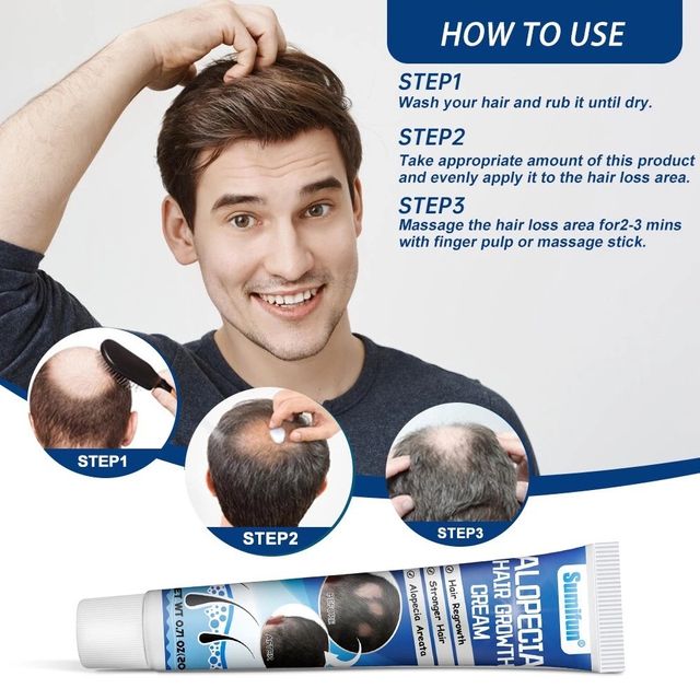 Kem Mọc T&oacute;c Alopecia Hair Growth Cream