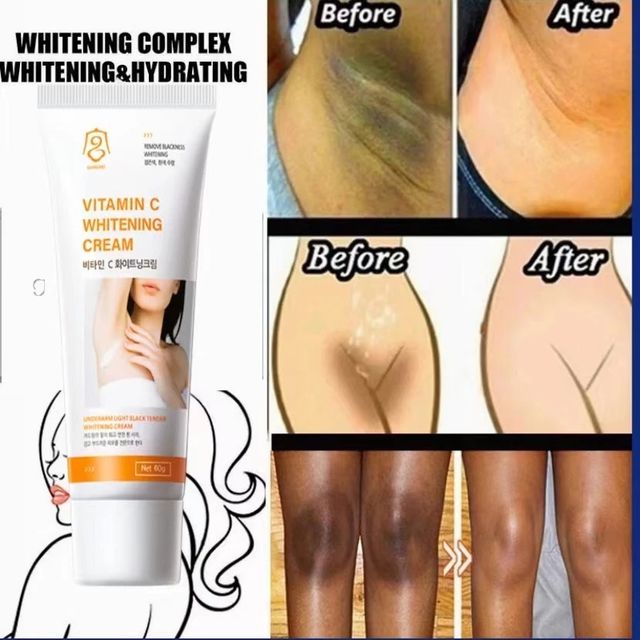 H&agrave;n Quốc Vitamin C Kem