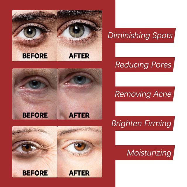 Kem dưỡng Retinol