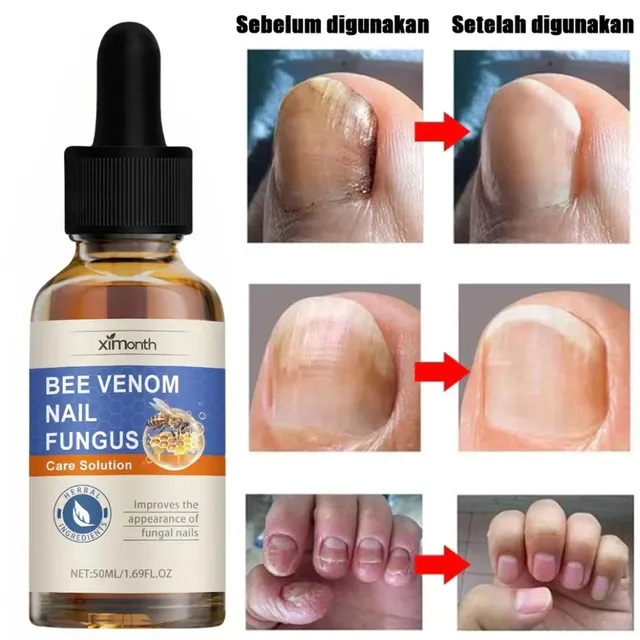 M&oacute;ng tay ch&acirc;n khỏe mạnh