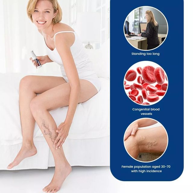 Chai Xịt Suy Gi&atilde;n Tĩnh Mạch Thảo Mộc H&igrave;nh 6