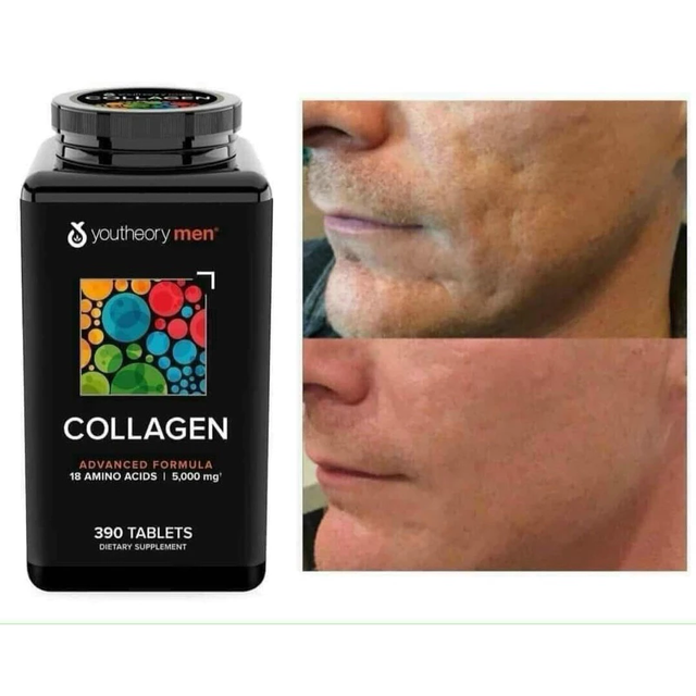 Vi&ecirc;n Collagen Youtheory cho nam giới