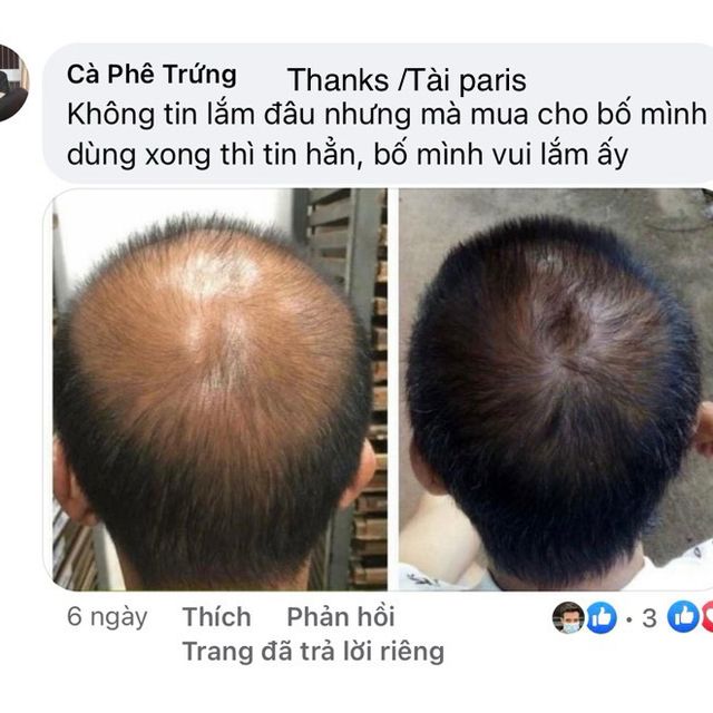 Vi&ecirc;n Uống Mọc T&oacute;c Arkopharma forcapil Anti-Chute 90 vi&ecirc;n