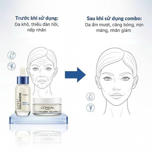 Kem Dưỡng Da L&rsquo;Or&eacute;al Collagen Expert 50ml