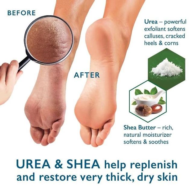 Kem Dưỡng Da Ch&acirc;n Eucerin UreaRepair PLUS 10% Urea Foot Cream 100ml