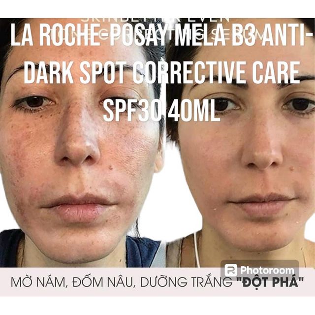 Kem Mờ N&aacute;m La Roche-Posay