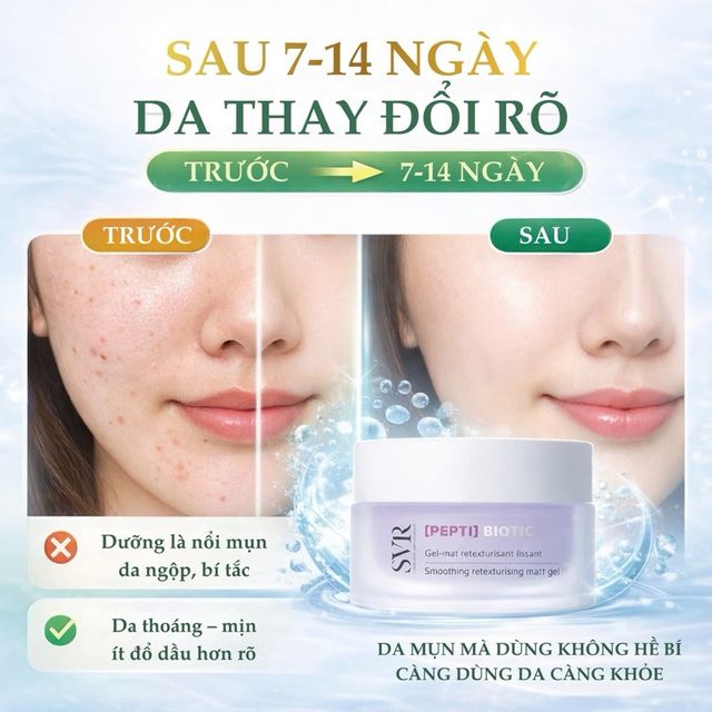 Kem SVR Pepti-Biotic