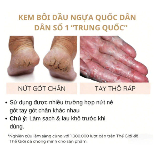 Kem Dưỡng Ẩm Dầu Ngựa