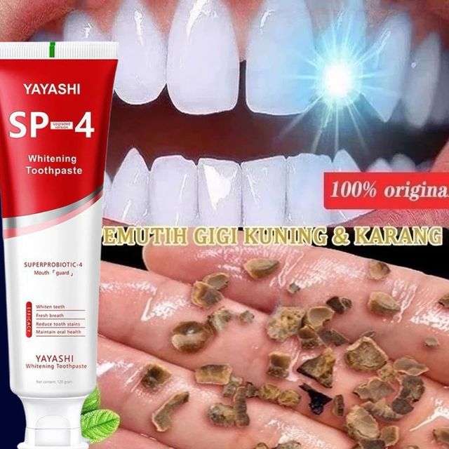 Sản phẩm kem đ&aacute;nh răng SP-4