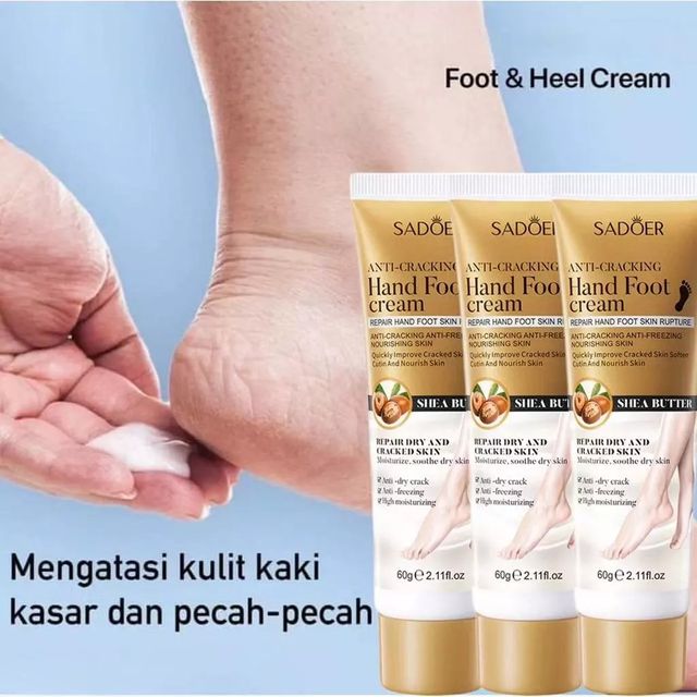 Kem Dưỡng Ẩm Chống Nứt Nẻ G&oacute;t Ch&acirc;n
