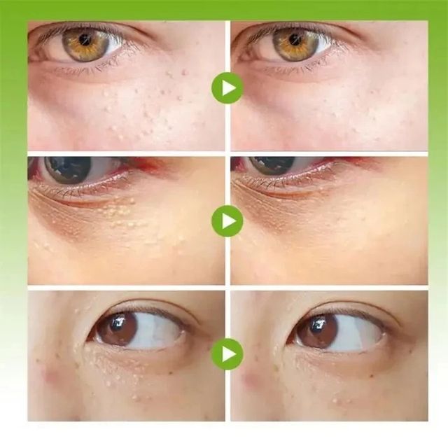 Kem mắt Vitamin E nguy&ecirc;n chất