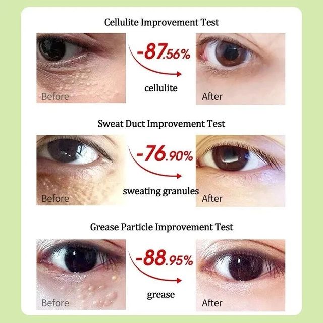 Kem mắt Vitamin E nguy&ecirc;n chất