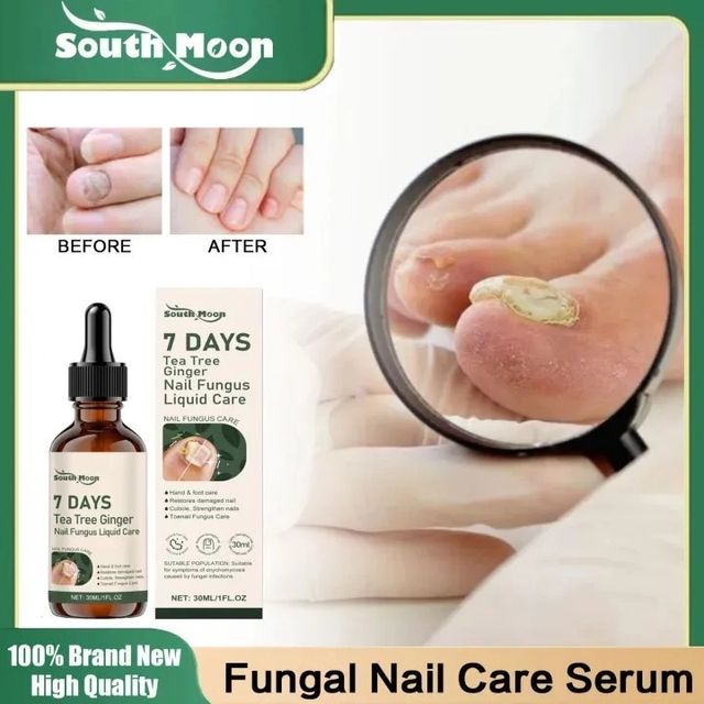 Serum Tẩy Nấm M&oacute;ng Tay Ch&acirc;n Thảo Mộc 7 DAYS