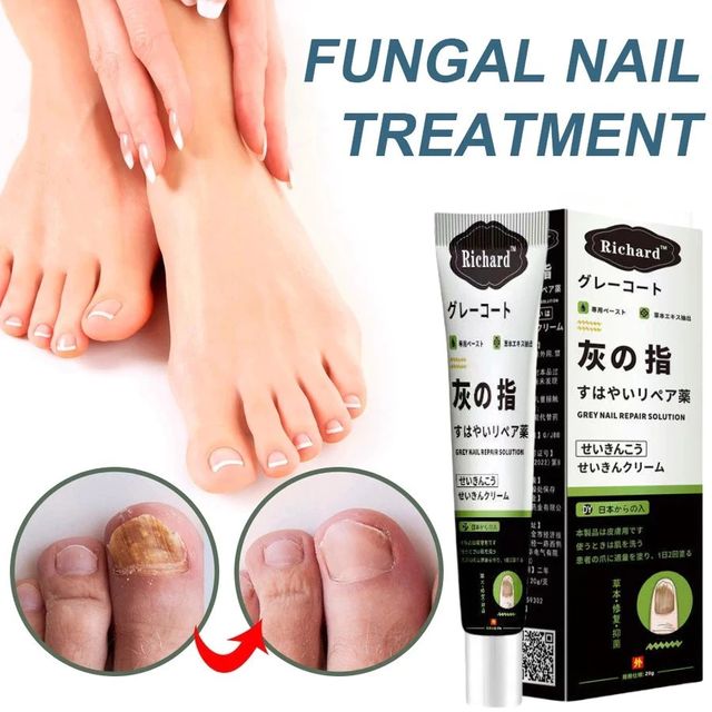 Kem sửa hỗ trợ m&oacute;ng Richard