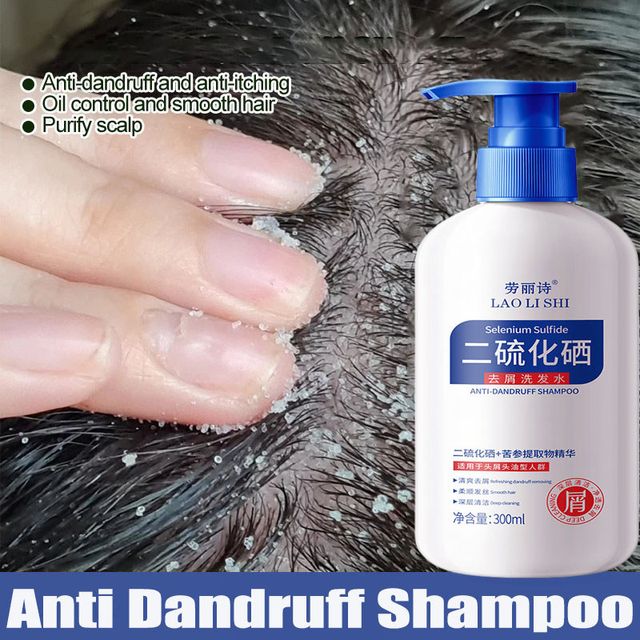 Dầu gội sạch g&agrave;u 2