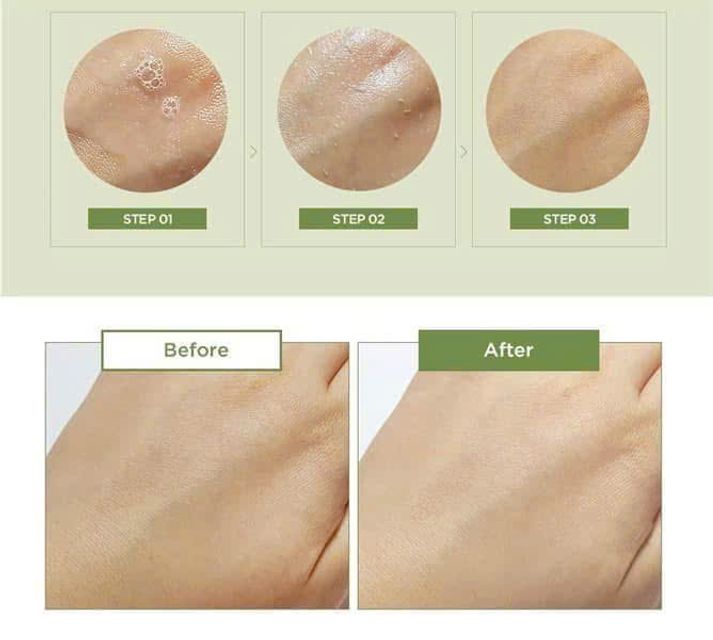 Vẻ đẹp tươi s&aacute;ng với Tẩy Da Cngừng hẳn Body Peel