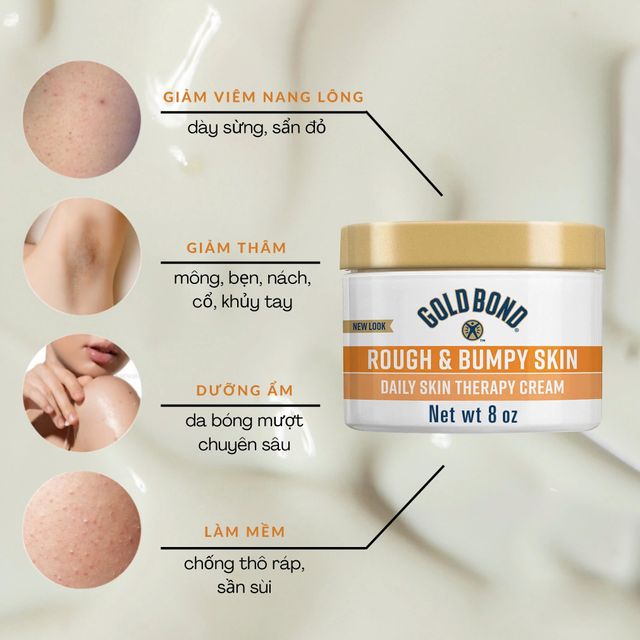 Sản phẩm Kem dưỡng da body Gold Bond Ultimate