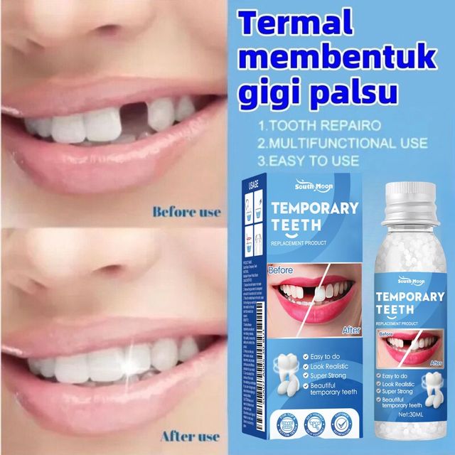 Keo Nhựa Răng Sửa hỗ trợ Định H&igrave;nh Răng