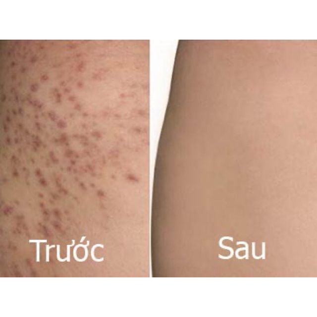 Sản phẩm Freeskin