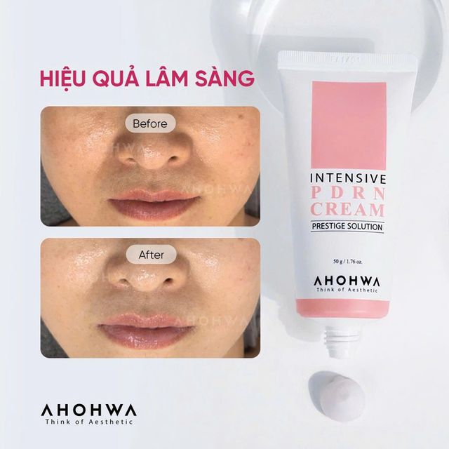 Th&agrave;nh phần Ahohwa Intensive PDRN Cream