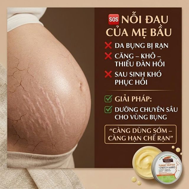 Kem Palmer's Tummy Butter