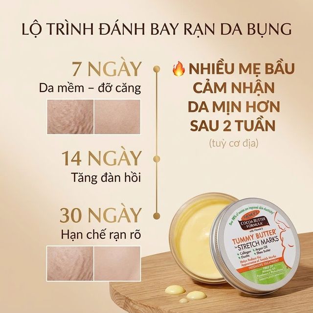 Kem ngừa rạn da Palmer's