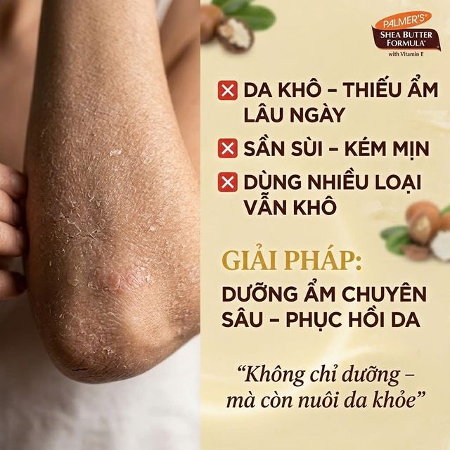 Khả năng dưỡng ẩm của Palmer's
