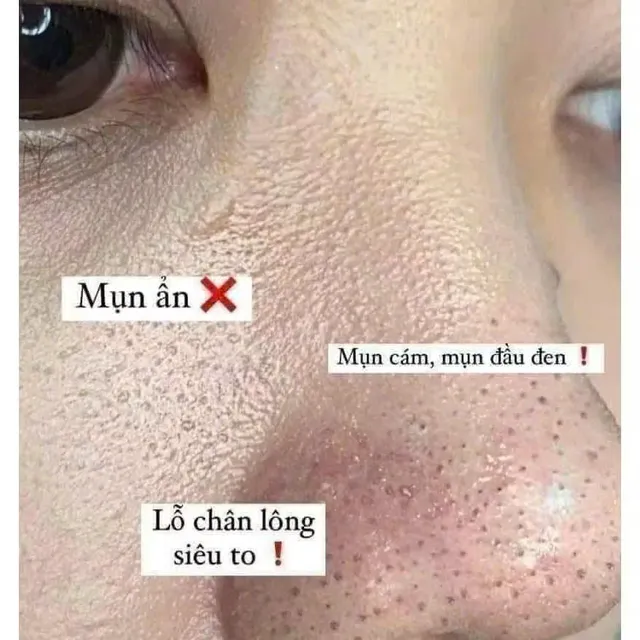 Đặt h&agrave;ng bộ sản phẩm BHA v&agrave; Niacinamide