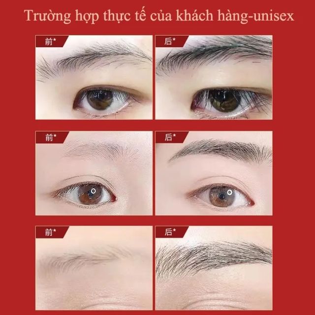 Serum Hỗ trợ Dưỡng 4