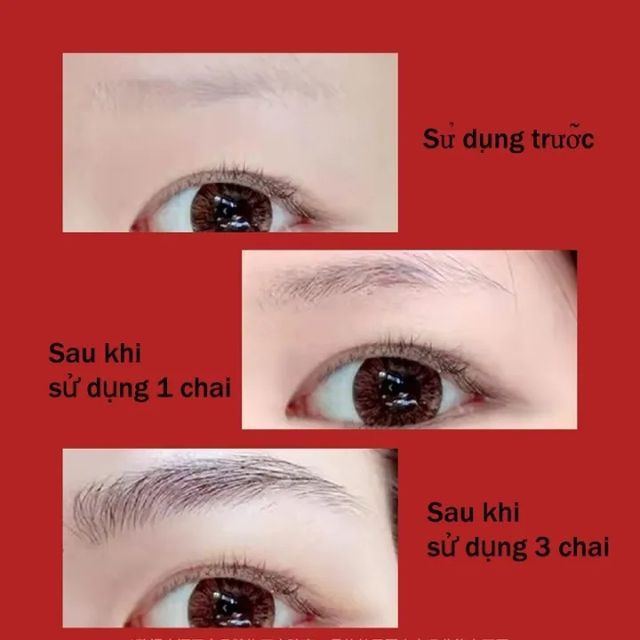 Serum Hỗ trợ Dưỡng 5