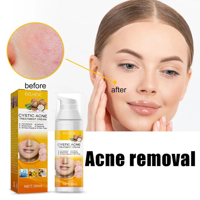 Hướng dẫn sử dụng kem