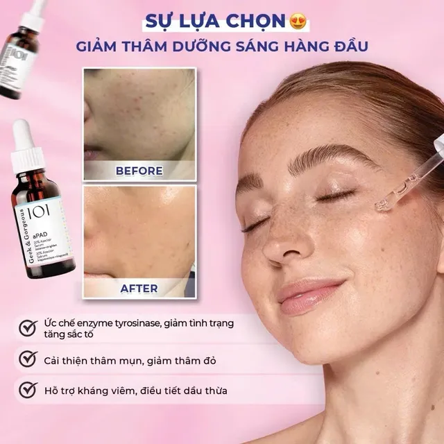 Sản phẩm aPAD