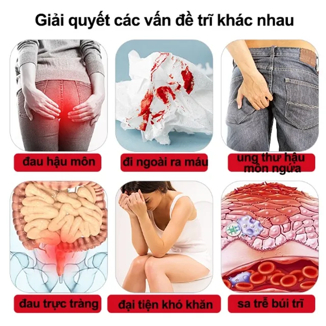 Kem b&ocirc;i trĩ gel Nhật Bản