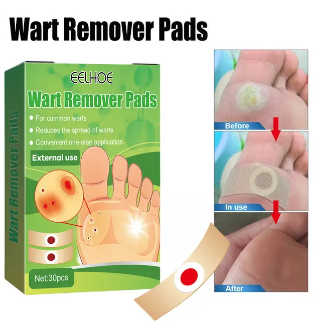 Miếng d&aacute;n plasters hiệu quả