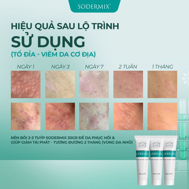 Hướng dẫn sử dụng Sodermix