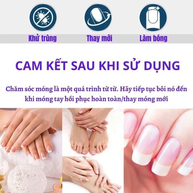 Kem nấm m&oacute;ng tay 20g