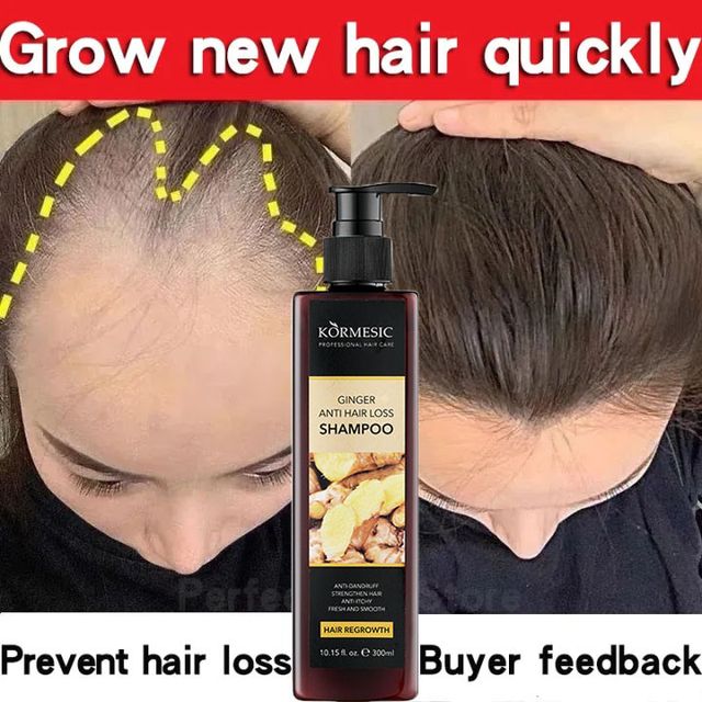 Dầu Gội K&iacute;ch Th&iacute;ch Mọc T&oacute;c