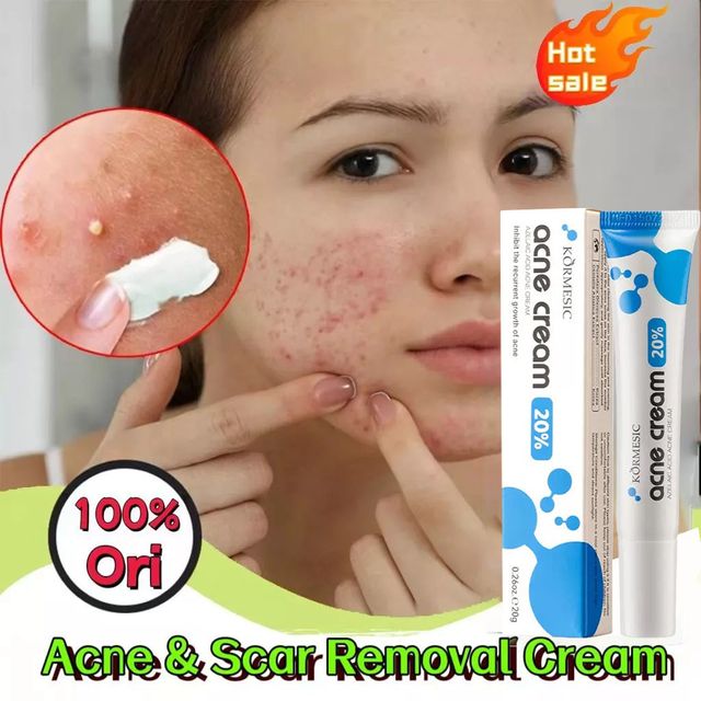 AZELAIC ACID Kem chấm mụn