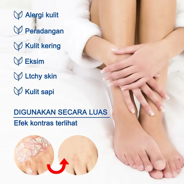 Kem hỗ trợ chuy&ecirc;n biệt