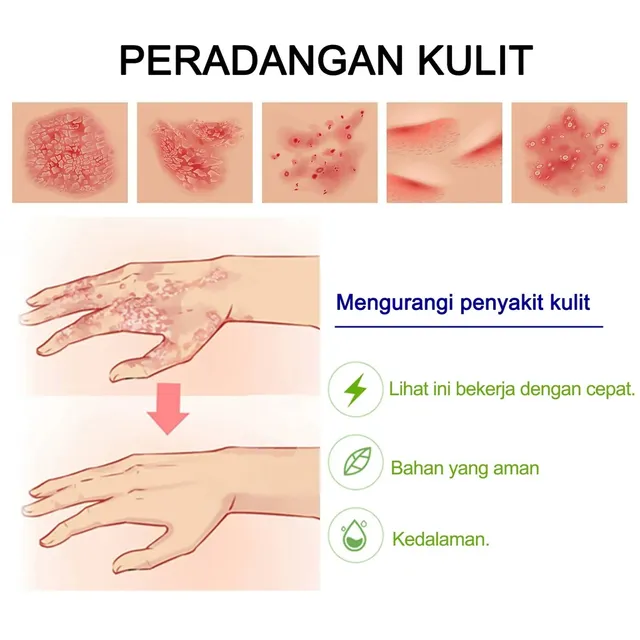 Hướng dẫn sử dụng kem