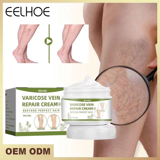 Kem Giảm Suy Gi&atilde;n Tĩnh Mạch