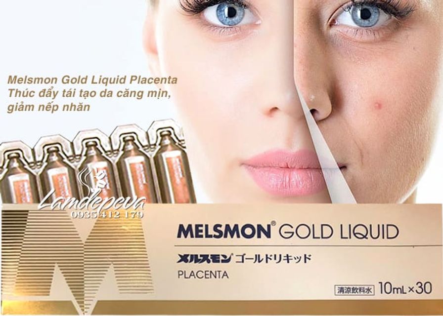 Nước uống nhau thai ngựa Melsmon Gold