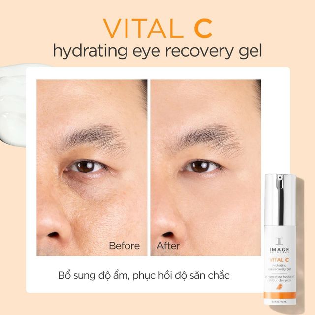 Kem mắt Image Skincare Vital C