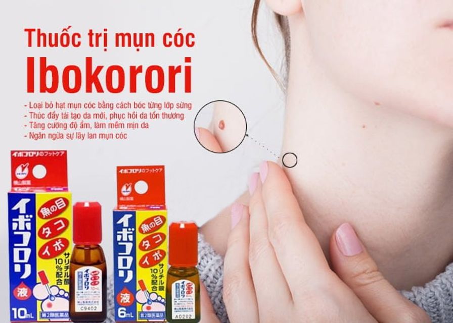 Ibokorori Nhật Bản