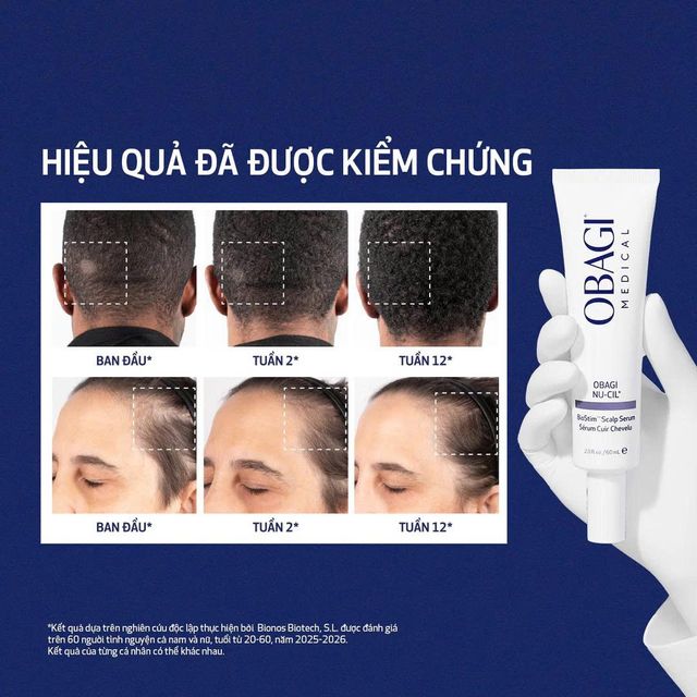 Serum Dưỡng Da Đầu v&agrave; Nang T&oacute;c OBAGI NU-CIL&reg; BIOSTIM&trade;
