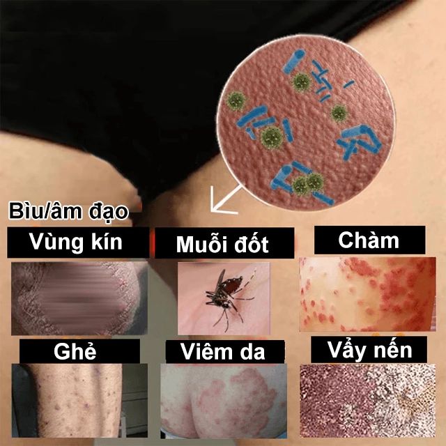 H&igrave;nh ảnh hướng dẫn sử dụng kem