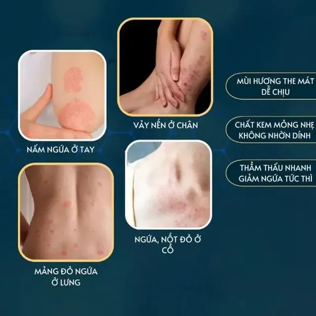 Kem B&ocirc;i Da Nhật Bản 15G