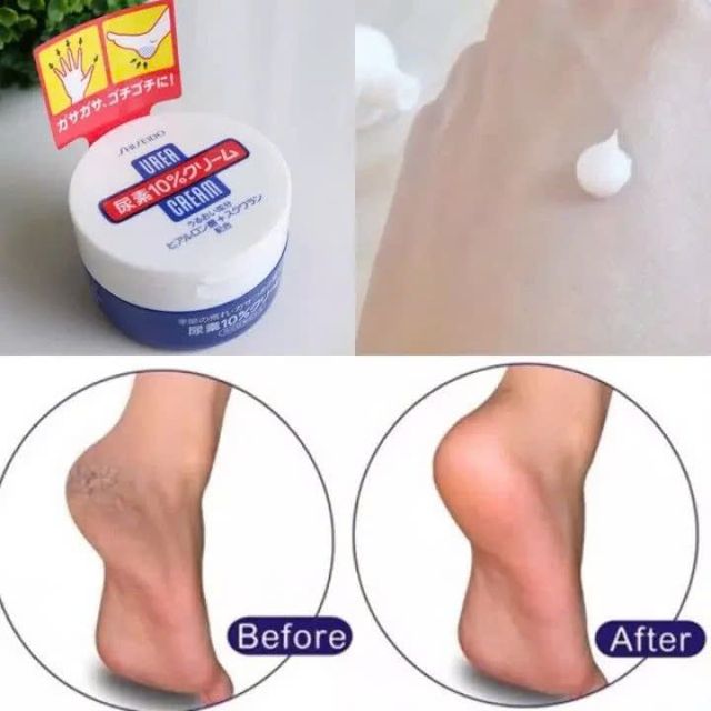 Shiseido Urea Cream
